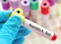 Hepatitis A: Se confirman 34 nuevos casos y Argentina enfrenta un alerta sanitaria
