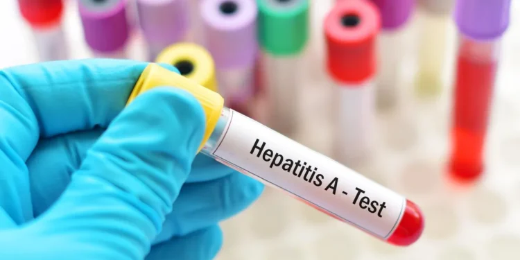 Hepatitis A: Se confirman 34 nuevos casos y Argentina enfrenta un alerta sanitaria