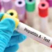 Hepatitis A: Se confirman 34 nuevos casos y Argentina enfrenta un alerta sanitaria