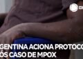 Se registraron 4 nuevos casos de Mpox y totalizan 15 en el año