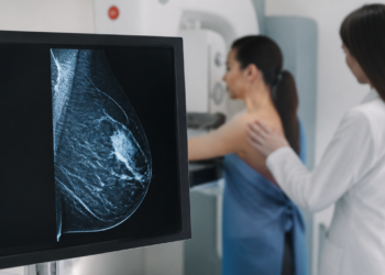 Cáncer de mama: hallan una secuela que puede persistir en las arterias años después de la recuperación
